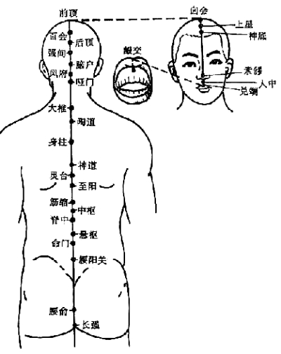 艾灸療法治療頸椎病(圖)